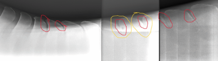 Kissing spines x-ray - Dr. Brent Barrett of Barrett Equine Lamenes - Ocala, FL and Colorado Springs, Colorado, CO 352-456-9824