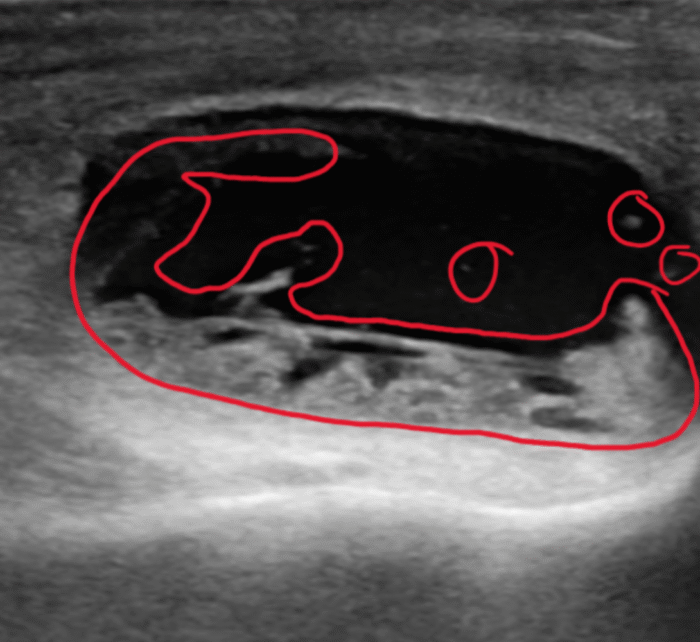 Ultrasound stifle – Barrett Equine Lameness – Ocala, FL and Colorado Springs, CO Ultrasound stifle - Barrett Equine Lameness - Ocala, FL and Colorado Springs, CO