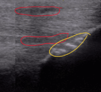 Ultrasound suspensory branch – Barrett Equine Lameness – Ocala, FL and Colorado Springs, CO Ultrasound suspensory branch - Barrett Equine Lameness - Ocala, FL and Colorado Springs, CO