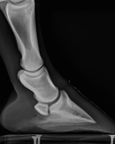 Hoof pastern axis, Foot imbalance RF - Podiatry - Barrett Equine Lameness - Ocala, FL and Colorado Springs, CO